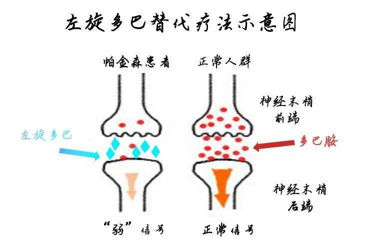 帕金森患者的福音！南洋理工大学科学家研制出缓释型微囊制剂