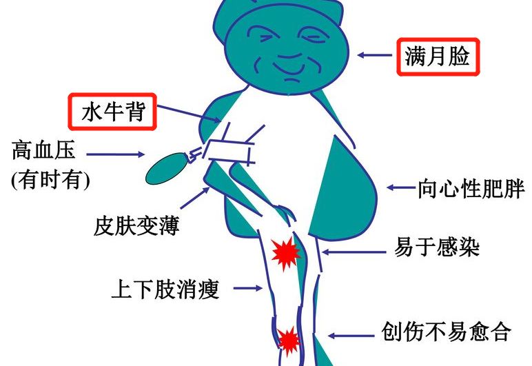 新加坡官方封禁！这些儿童药膏可能让孩子发育困难