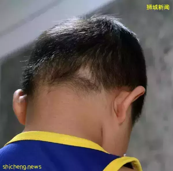 患上多系統炎症綜合征 4歲“小鬥士”憑毅力征服病魔