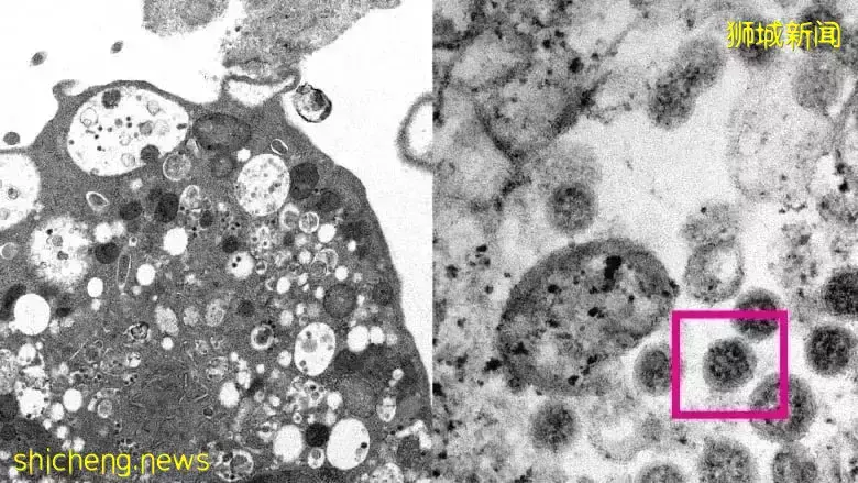 最新！奥密克戎亚变种毒株来到新加坡，可在皮肤存活21小时