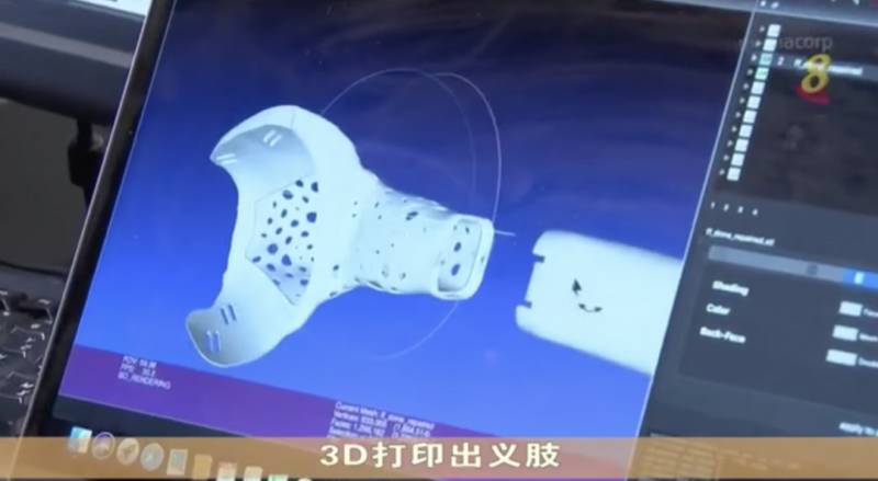 小坡岛科研 新科大与陈笃生医院共同打造3D打印义肢