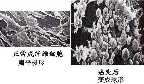 小坡岛科研 国大学者发现癌症形成新机制