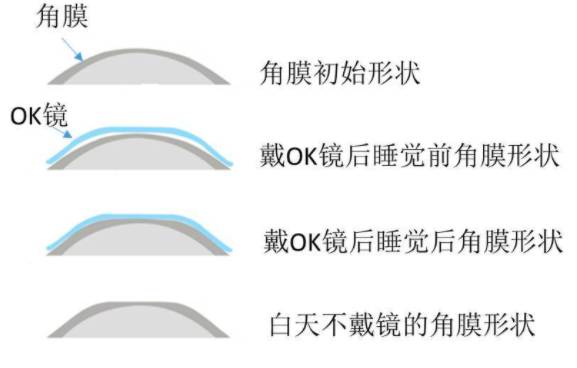 新加坡眼科医院最全指南 为你心灵的窗户做个体检吧