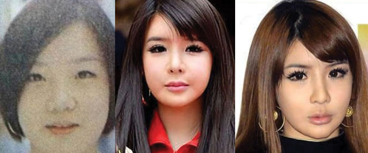 Park-Bom-plastic-surgery.jpg