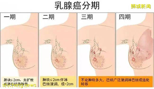 女佣在新加坡患乳腺癌！手术已花$2万多，她不想回国，我该怎么办